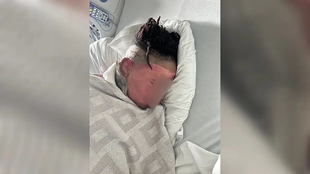 Ein Junge aus Georgia musste nach dem Vorfall operiert werden.