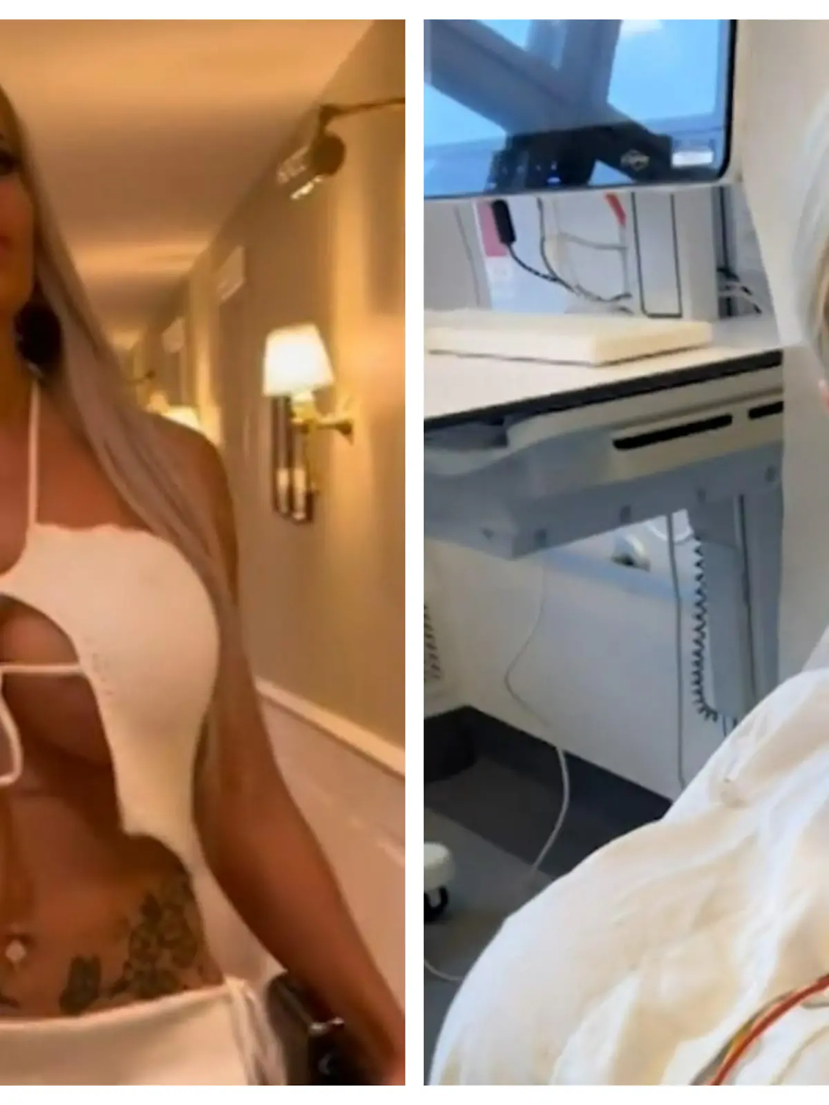 Gittes Beauty-OP war für den Arsch!
