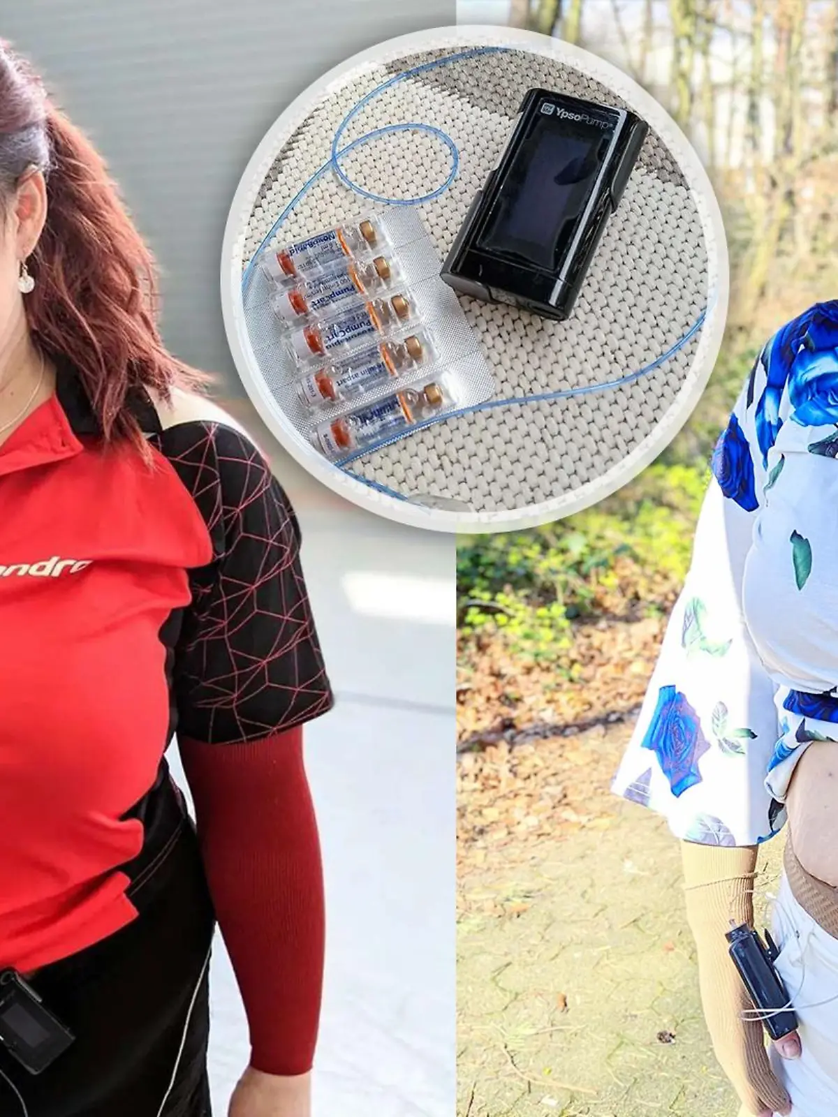 Kathi Schanz beim Tischtennis und mit ihrer Diabetes-Ausstattung.