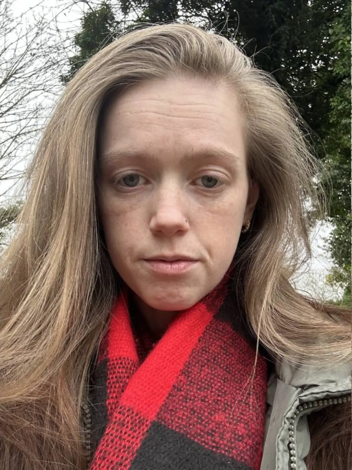 Elise leidet an der seltenen Krankheit Achalasie.