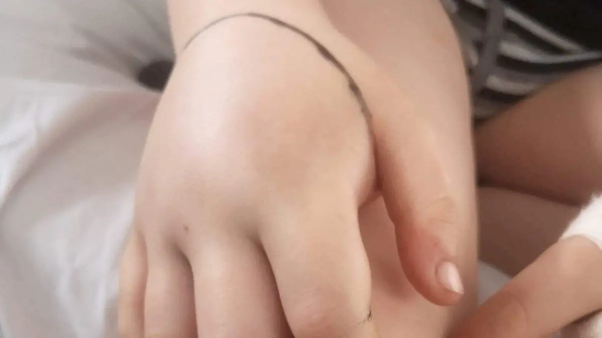 SONDERKONDITIONEN: Satzpreis!
Jake Closier's bitten hand. See SWNS story SWMDadder. An eight-year-old boy has been left 'traumatised' after nearly losing his life after he was bitten on the hand by a venomous adder on a beach. Jake Closier was walking along Hemsby beach in Norfolk with his parents, Sophie, 32 and Kenny, 33, last Tuesday (5/4). After falling down some sand dunes, Jake was shocked to learn that he had been bitten by a venomous adder. Initially unconcerned, Sophie - who has snakes as pet and has been bitten herself - thought the bite was from a non-venomous snake. / action press