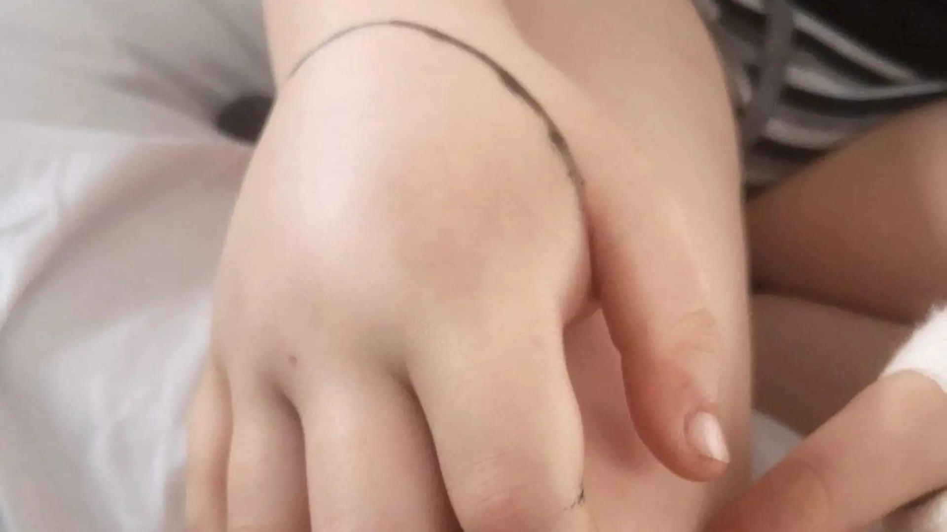 SONDERKONDITIONEN: Satzpreis!
Jake Closier's bitten hand. See SWNS story SWMDadder. An eight-year-old boy has been left 'traumatised' after nearly losing his life after he was bitten on the hand by a venomous adder on a beach. Jake Closier was walking along Hemsby beach in Norfolk with his parents, Sophie, 32 and Kenny, 33, last Tuesday (5/4). After falling down some sand dunes, Jake was shocked to learn that he had been bitten by a venomous adder. Initially unconcerned, Sophie - who has snakes as pet and has been bitten herself - thought the bite was from a non-venomous snake. / action press