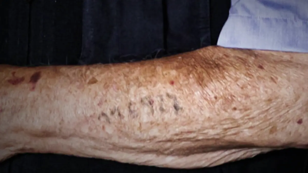 Eine Nummer ist auf einen Arm tätowiert.