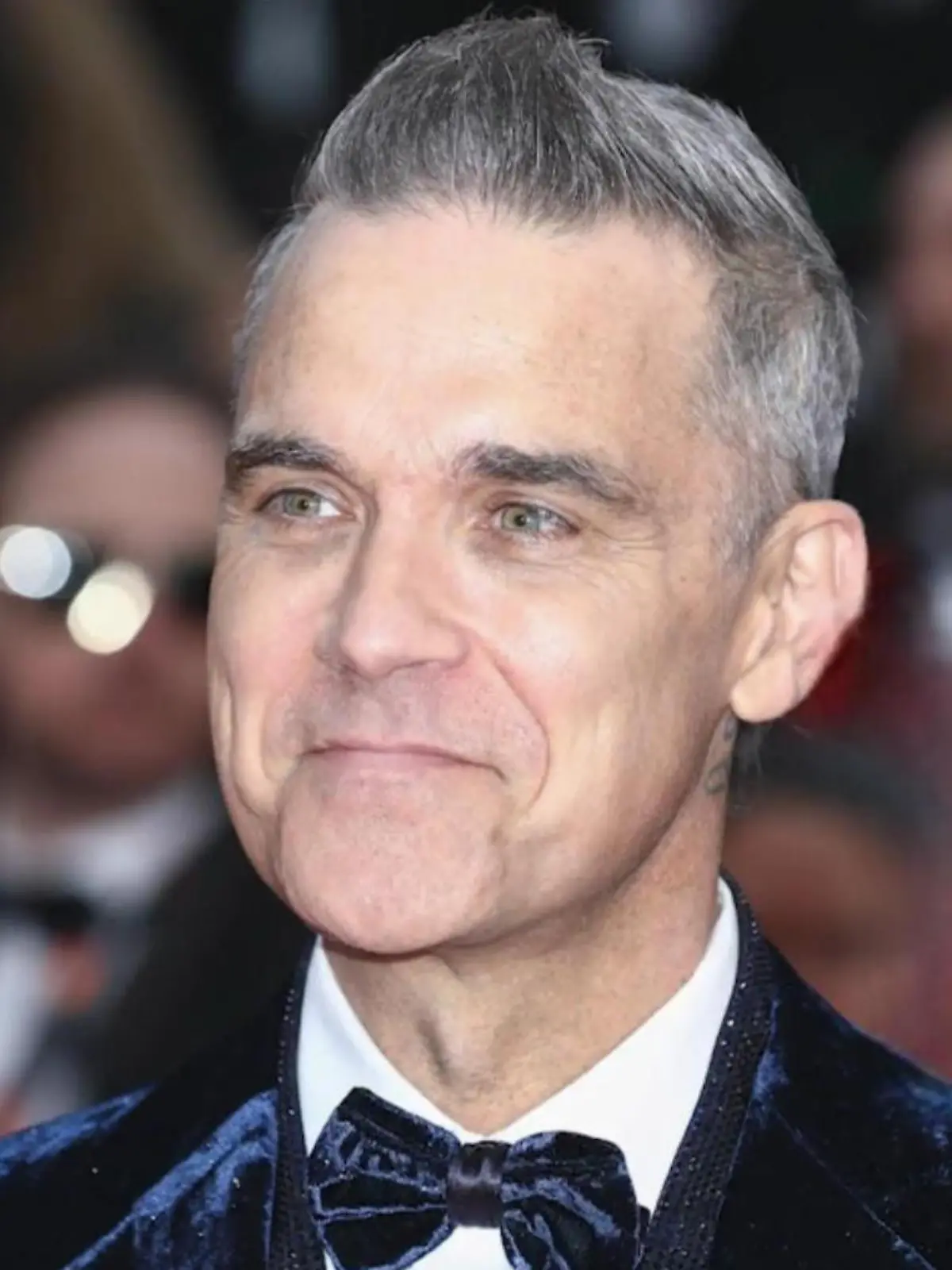 Vorher-Nachher-Bilder Robbie Williams Ozempic