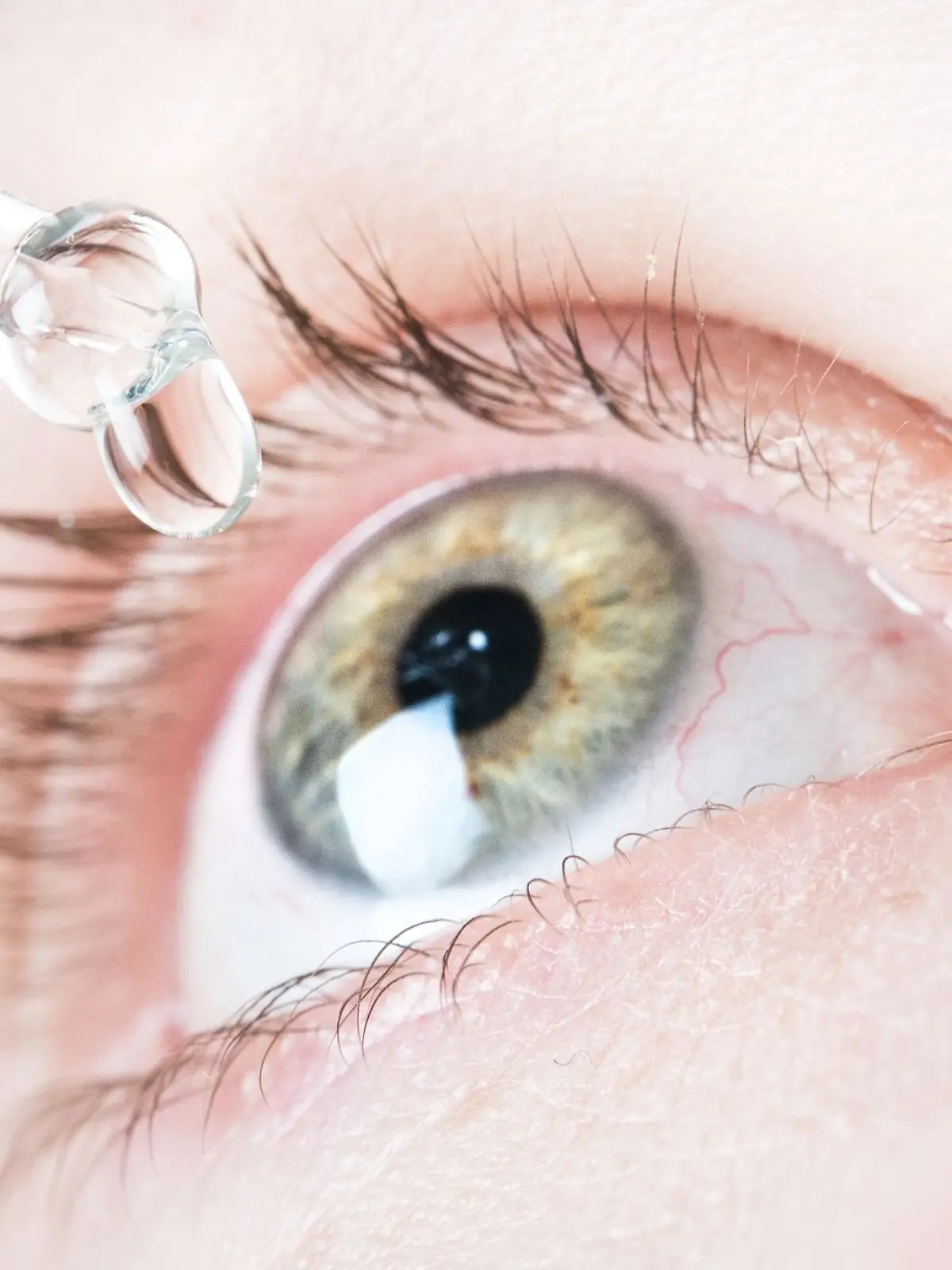 Bild zu: "Tropfen statt Brille – neue Behandlung soll stundenlang für klare Sicht sorgen"