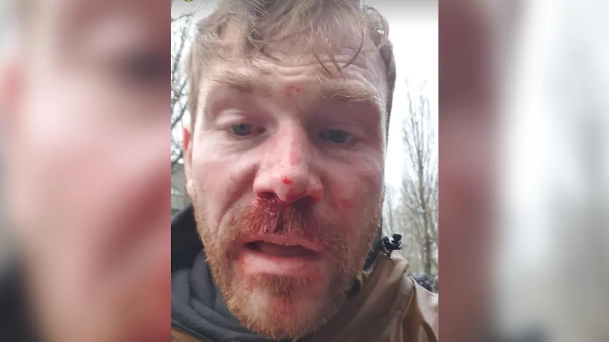 Gehörloser BVB-Fan brutal überfallen.