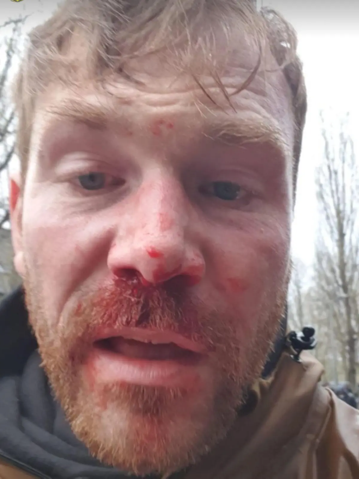 Gehörloser BVB-Fan brutal überfallen.