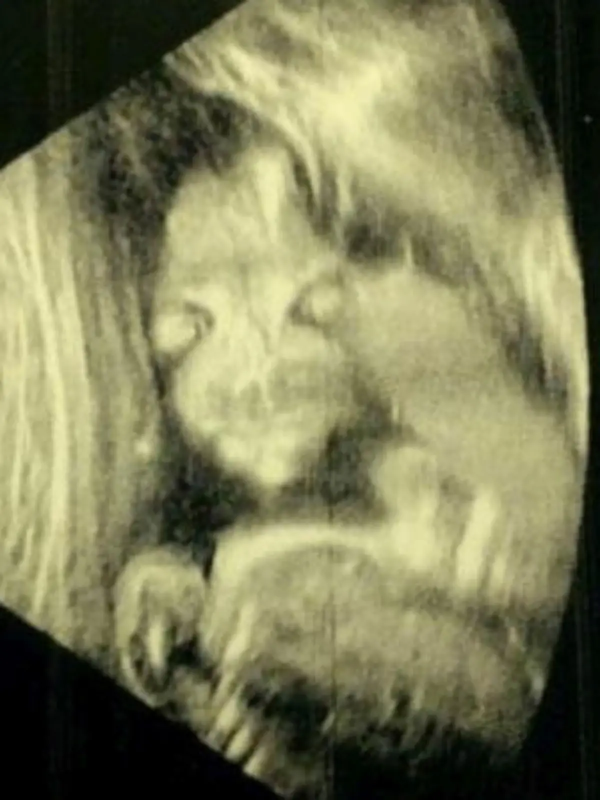 Jade Boyland hatte gehofft, die Ultraschall-Aufnahmen ihres Babys stolz Freunden und Familie zeigen zu können.
