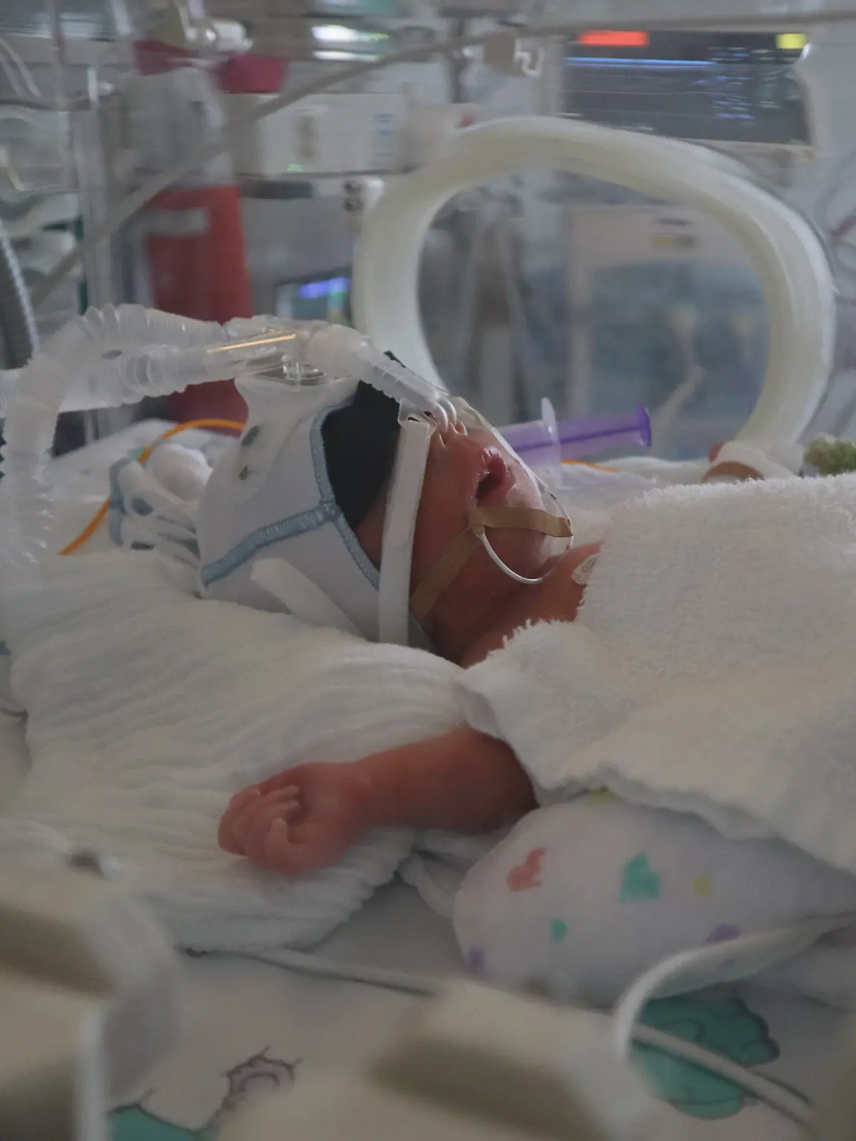 Noch brauchen der kleine David Christian und seine drei Geschwister Unterstützung bei der Atmung.