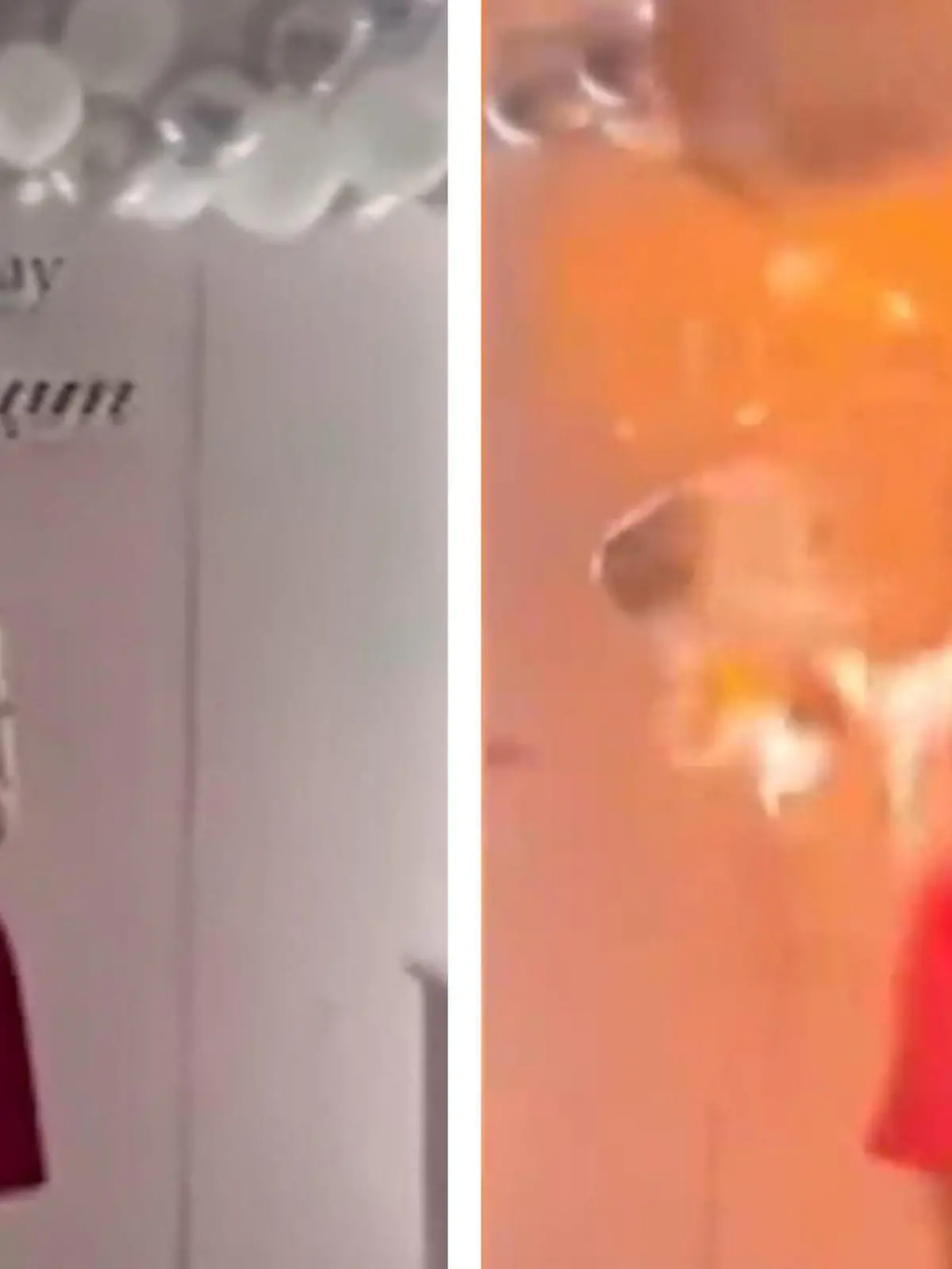 Ballon explodiert vor Gesicht – Geburtstagskind erleidet schwere Verbrennungen