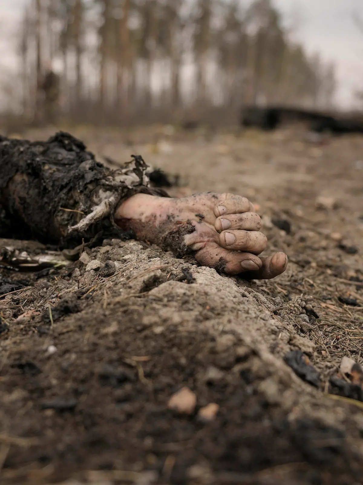 31.03.2022, Ukraine, Kiew: GRAPHIC CONTENT - Die Leiche eines gefallenen russischer Soldaten nach einem Angriff ukrainischer Streitkräfte auf russische Stellungen außerhalb von Kiew. Am Donnerstag, 31.03.2022, kam es in den Außenbezirken von Kiew und anderen Gebieten zu schweren Kämpfen. Foto: Vadim Ghirda/AP/dpa - ACHTUNG: Graphic Content +++ dpa-Bildfunk +++