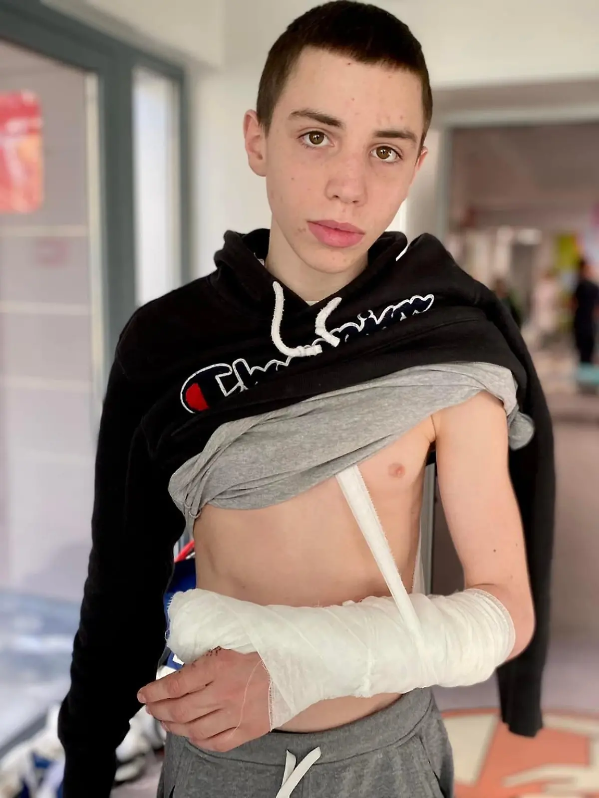 Yuriy wurde offenbar von russischen Soldaten verletzt. Sein Vater sei vor seinen Augen erschossen worden, erzählt er.