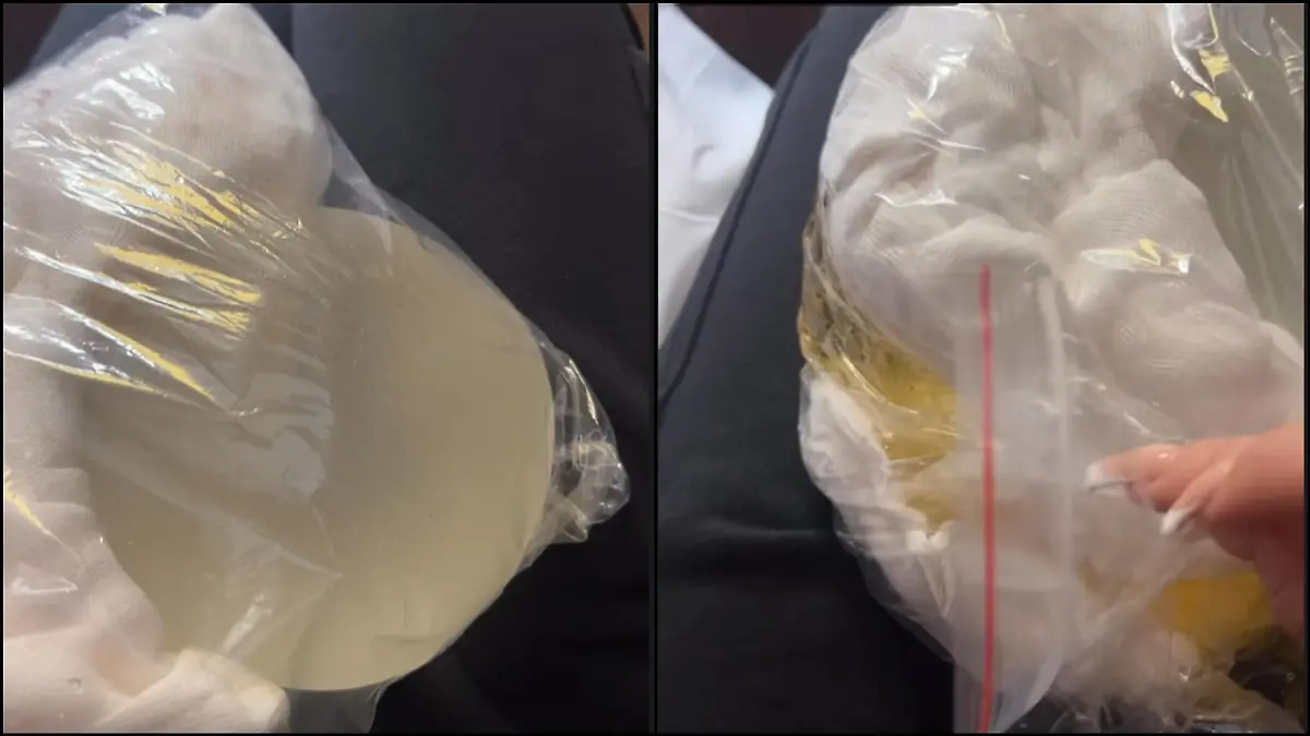 Autsch! Intaktes Brustimplantat versus geplatztes Brustimplantat auf der rechten Seite. Quelle: https://www.instagram.com/laylaslife_official/