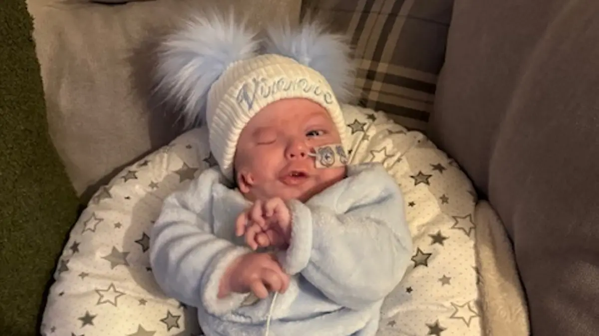 Baby Vinnie wurde mit einer seltenen Erkrankung geboren. Ihm wächst unter anderem ein Ohr aus der Wange, außerdem fehlt ihm ein Auge.