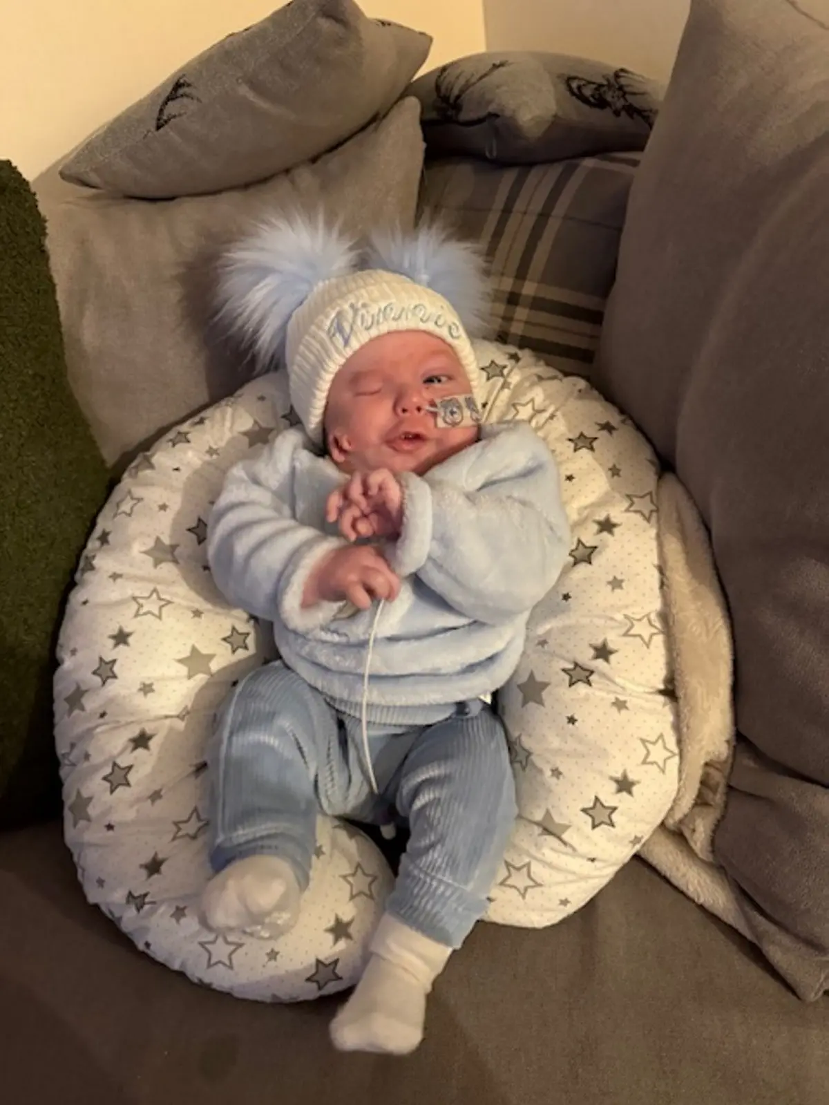 Baby Vinnie wurde mit einer seltenen Erkrankung geboren. Ihm wächst unter anderem ein Ohr aus der Wange, außerdem fehlt ihm ein Auge.