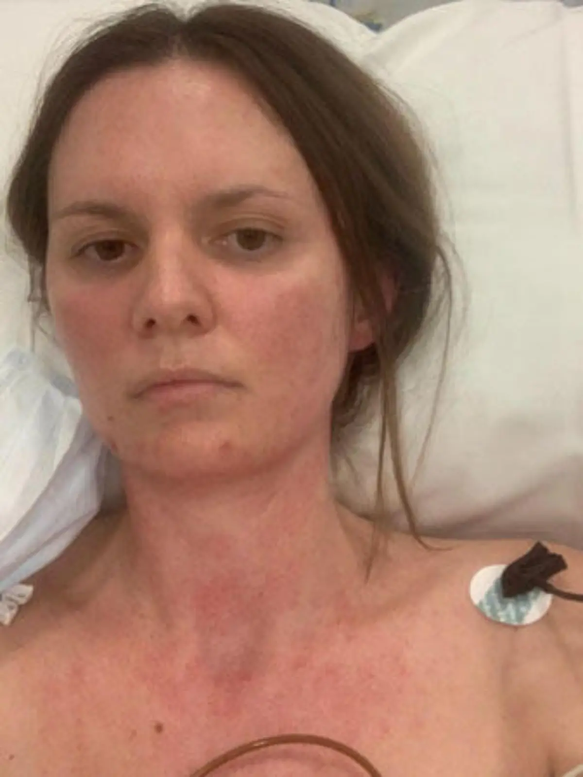 Instagram-Star und Travel-Influencerin Jessica Stein im Krankenbett