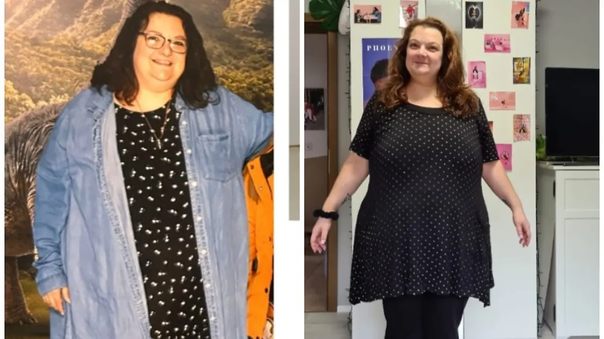 Fotocollage: Links Nadine vor der OP, rechts nachher.