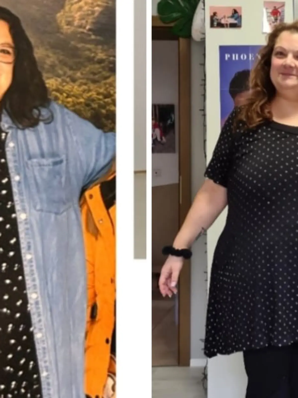 Fotocollage: Links Nadine vor der OP, rechts nachher.