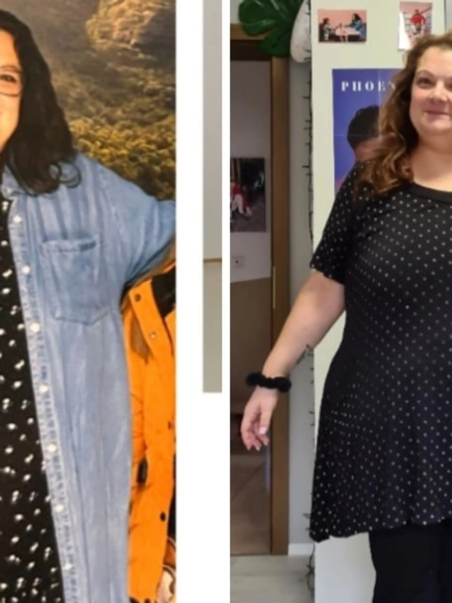 Fotocollage: Links Nadine vor der OP, rechts nachher.