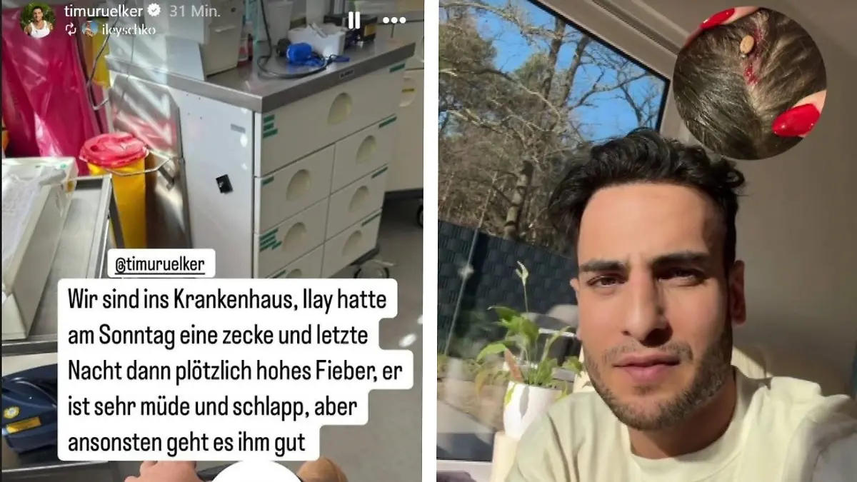 Timur Ülkers Sohn Ilay (5) wurde von einer Zecke gebissen, die sich am Kopf vollgesogen hat! Das erzählt der GZSZ-Schauspieler auf Instagram.