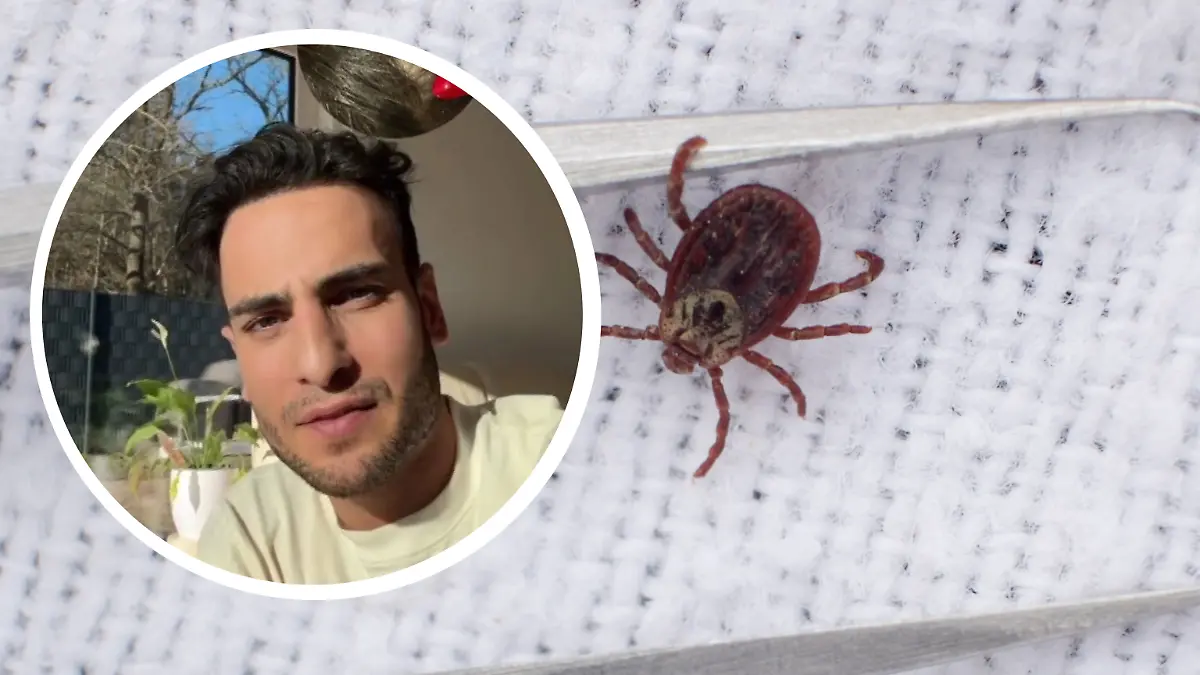 GZSZ-Schauspieler Timur Ülker (35) ist mit seinem Sohn ins Krankenhaus gefahren, weil dieser von einer Zecke gebissen wurde und Symptome aufzeigt.