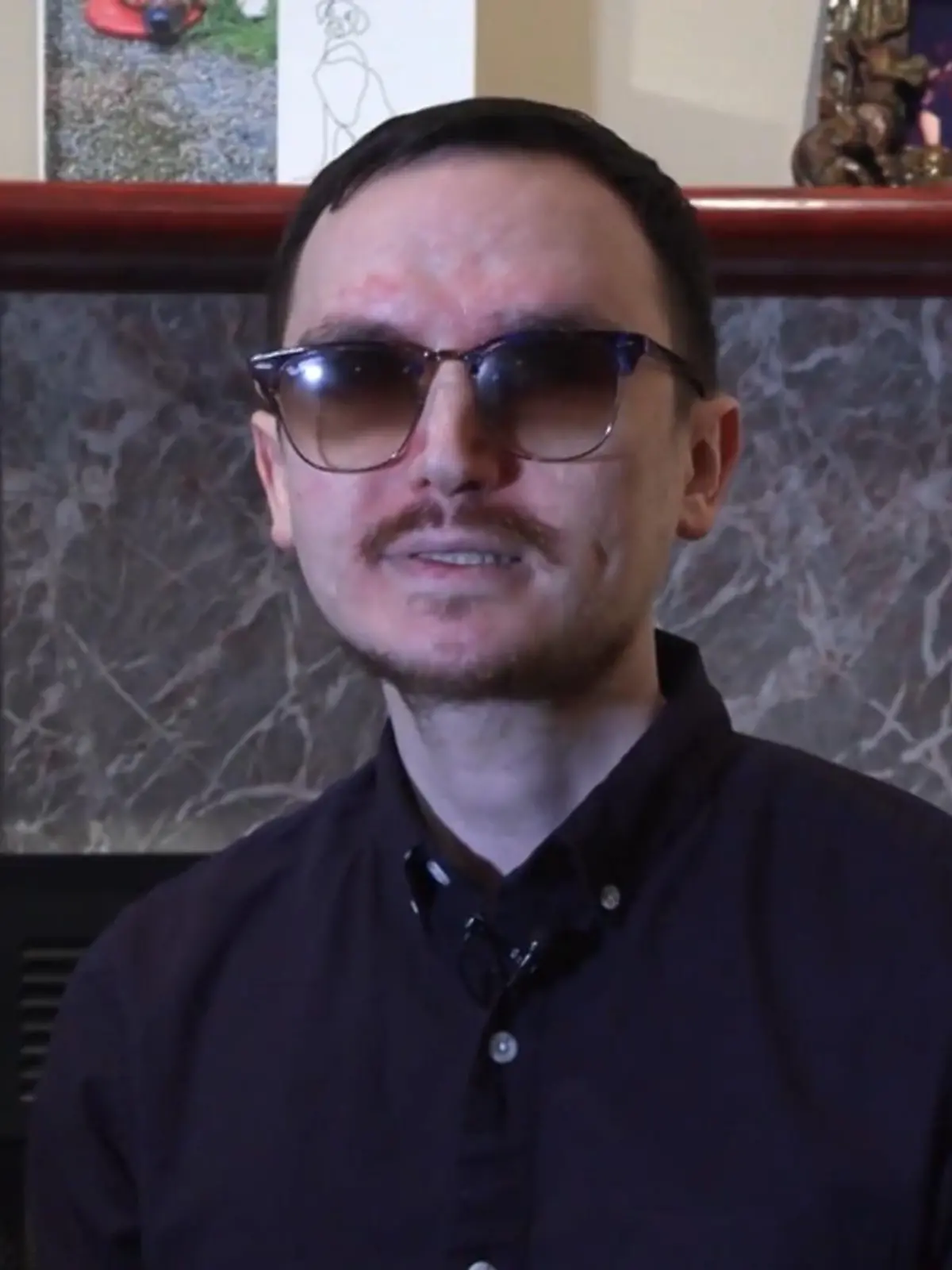 Bild zu: "Seit 20 Jahren blind! Irre OP soll Brent wieder sehen lassen"