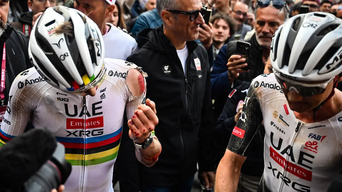 Der slowenische Radstar Tadej Pogacar nach der Zieldurchfahrt in Siena mit Blut an den Händen am 8. März 2025
