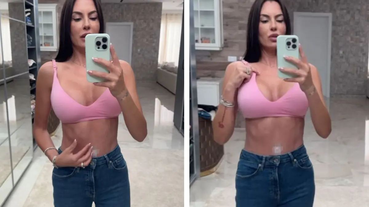 Anna-Maria Ferchichi zeigt ihren Bauch sechs Wochen nach Straffung.