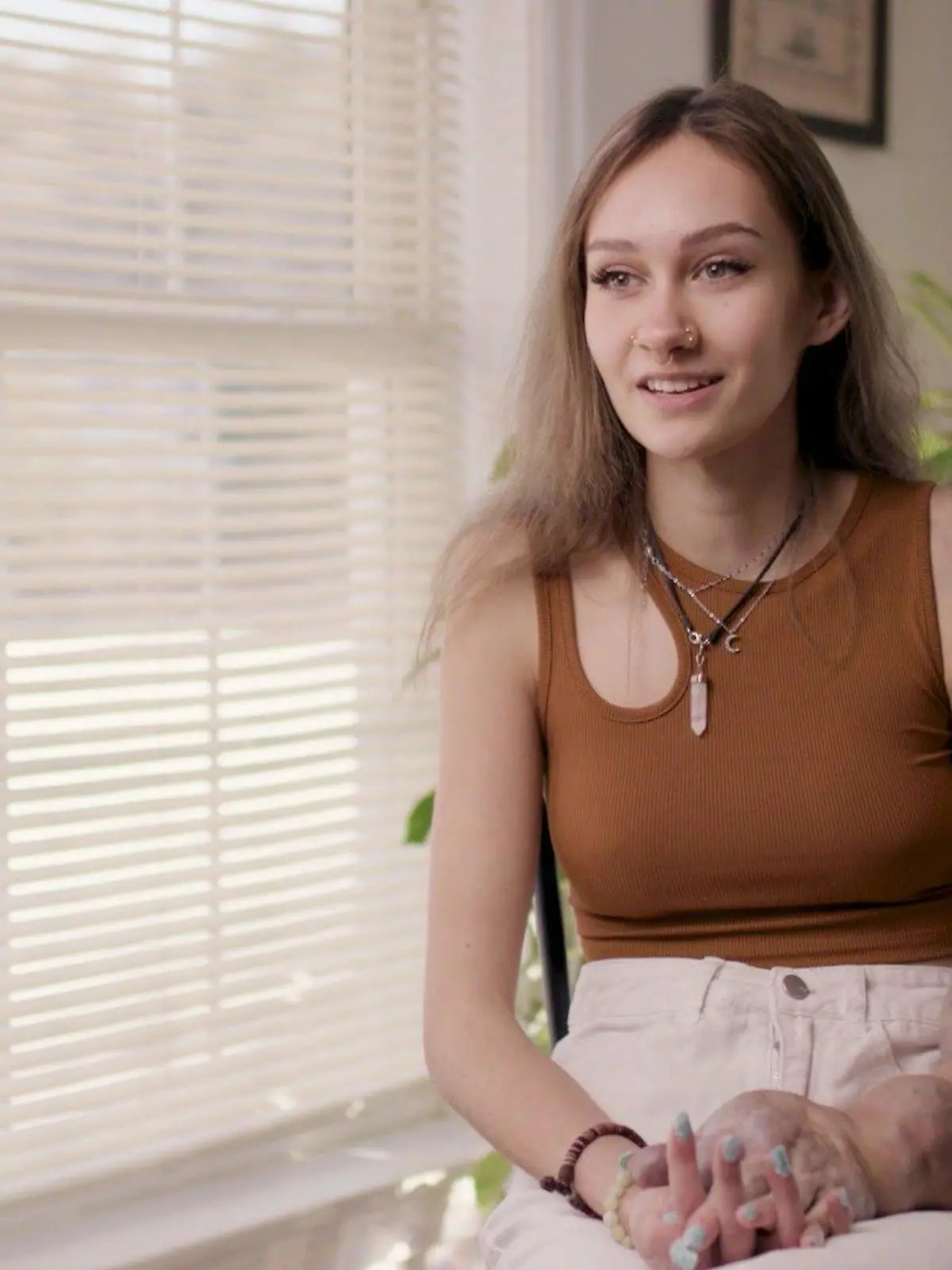 Olivia Klopchin (17) sitzt im Interview auf eine Stuhl. Ihre beiden Arme im direkten Vergleich sind gut zu erkennen.