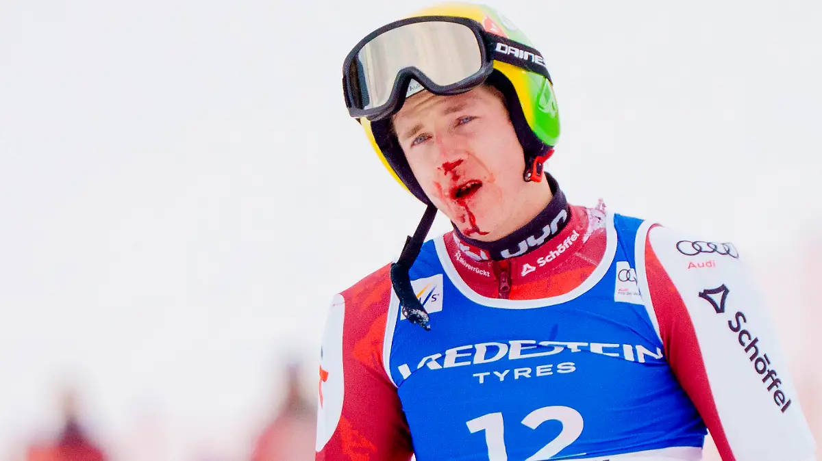 Raphael Haaser nach seinem Sturz im Riesenslalom-Weltcup in Hafjell/Norwegen mit blutverschiertem Gesicht im Ziel