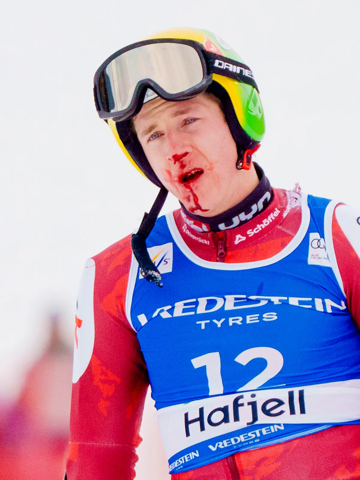 Raphael Haaser nach seinem Sturz im Riesenslalom-Weltcup in Hafjell/Norwegen mit blutverschiertem Gesicht im Ziel