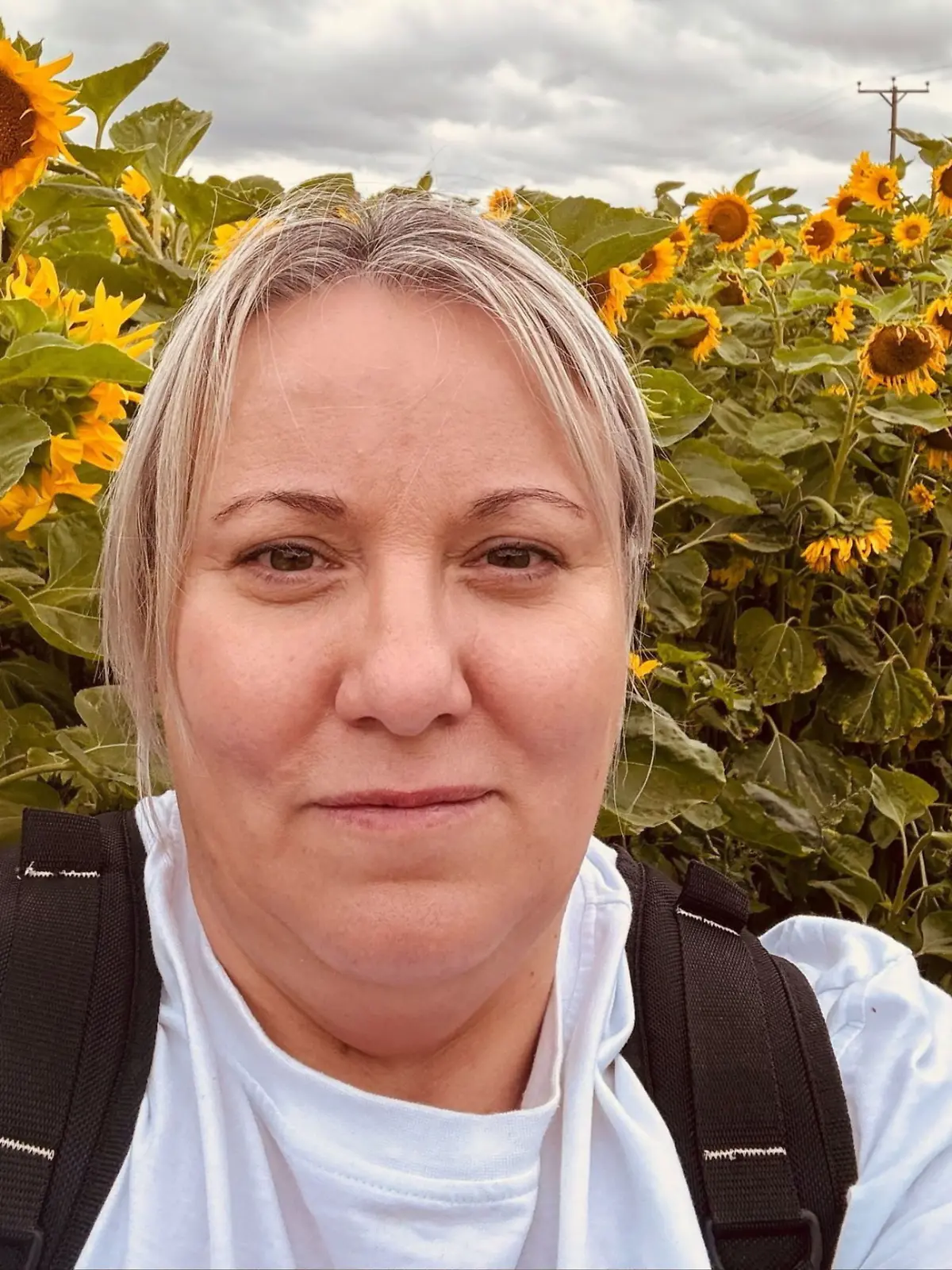 Angela Glover (51) aus Großbritannien gerät an einen Chirurgen, der regelmäßig OPs verpfuschte und Patienten sogar unter anderem falsche Knochen entfernte!