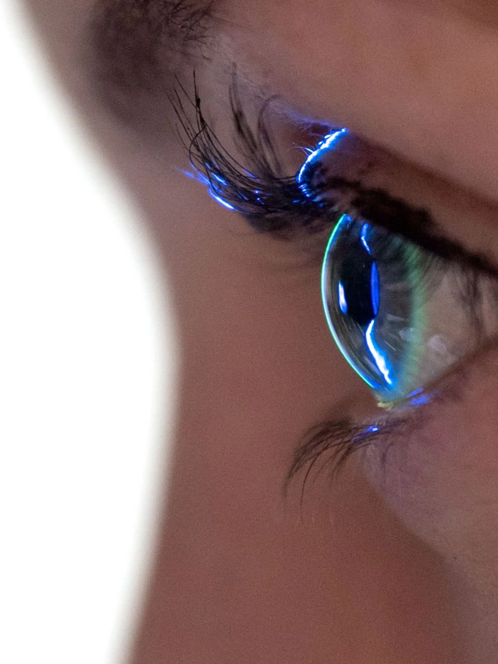 Bild zu: "Arzt operiert trotz Parkinson – Frau auf einem Auge erblindet
"