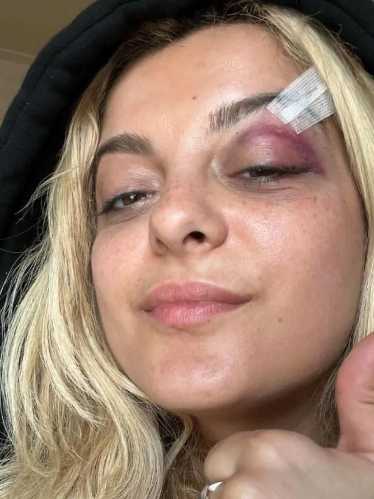 Bebe Rexha wurde während eines Konzerts von einem Handy an der Schläfe getroffen.