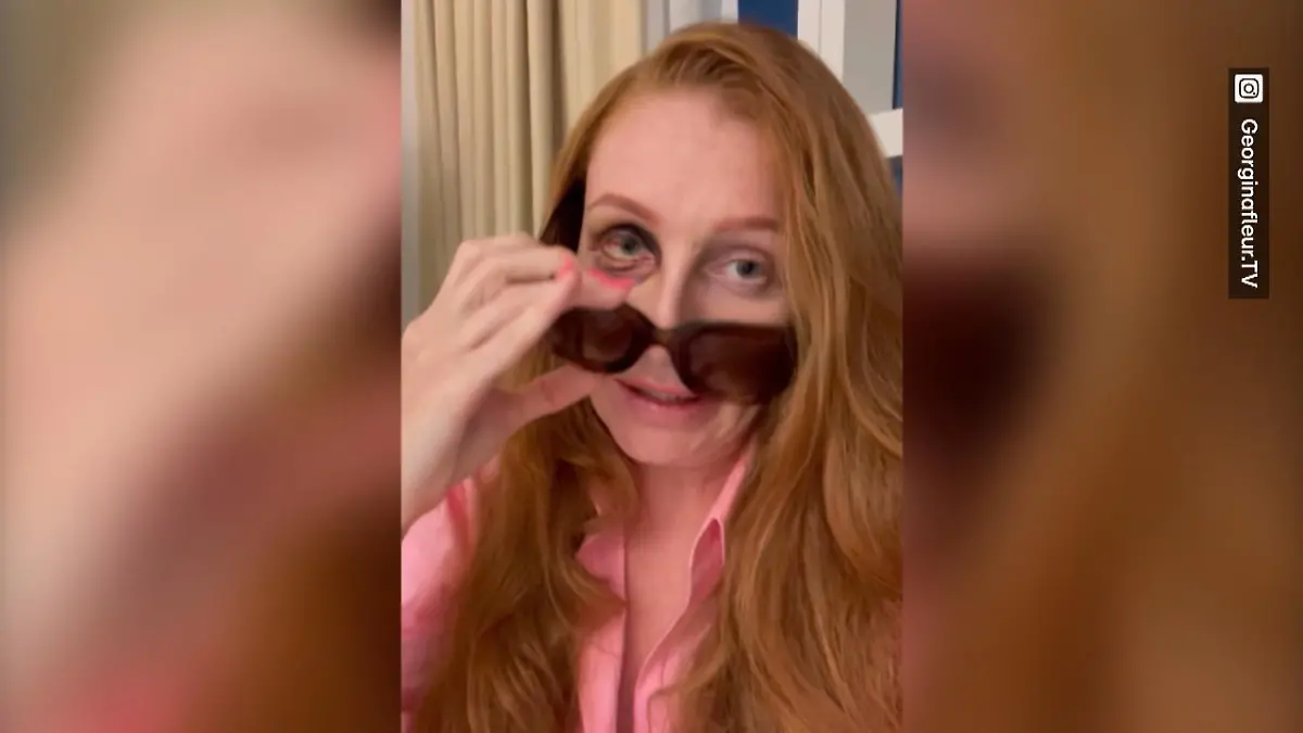 Unter Tränen zeigt Georgina Fleur ihr blaues Auge Schock-Aufnahmen