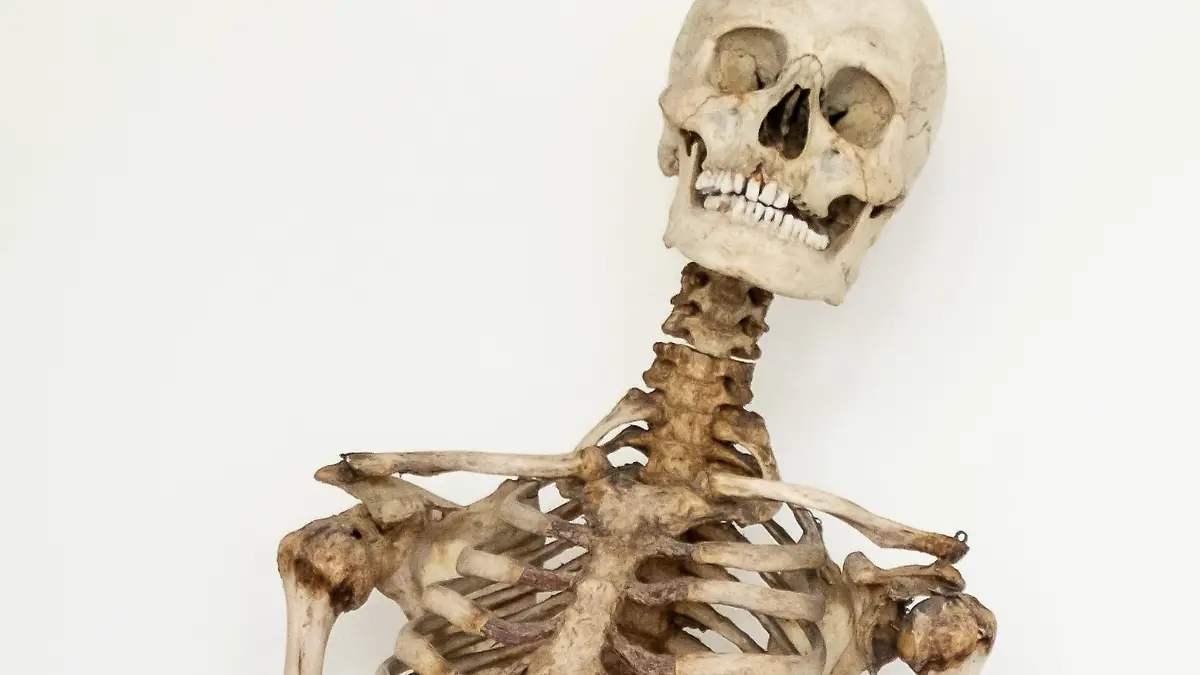 Dank wissenschaftlicher Analysen und eines Verwandten weiß man nun, dass dieses Skelett die sterblichen Überreste des Räubers Schinderhannes sind.