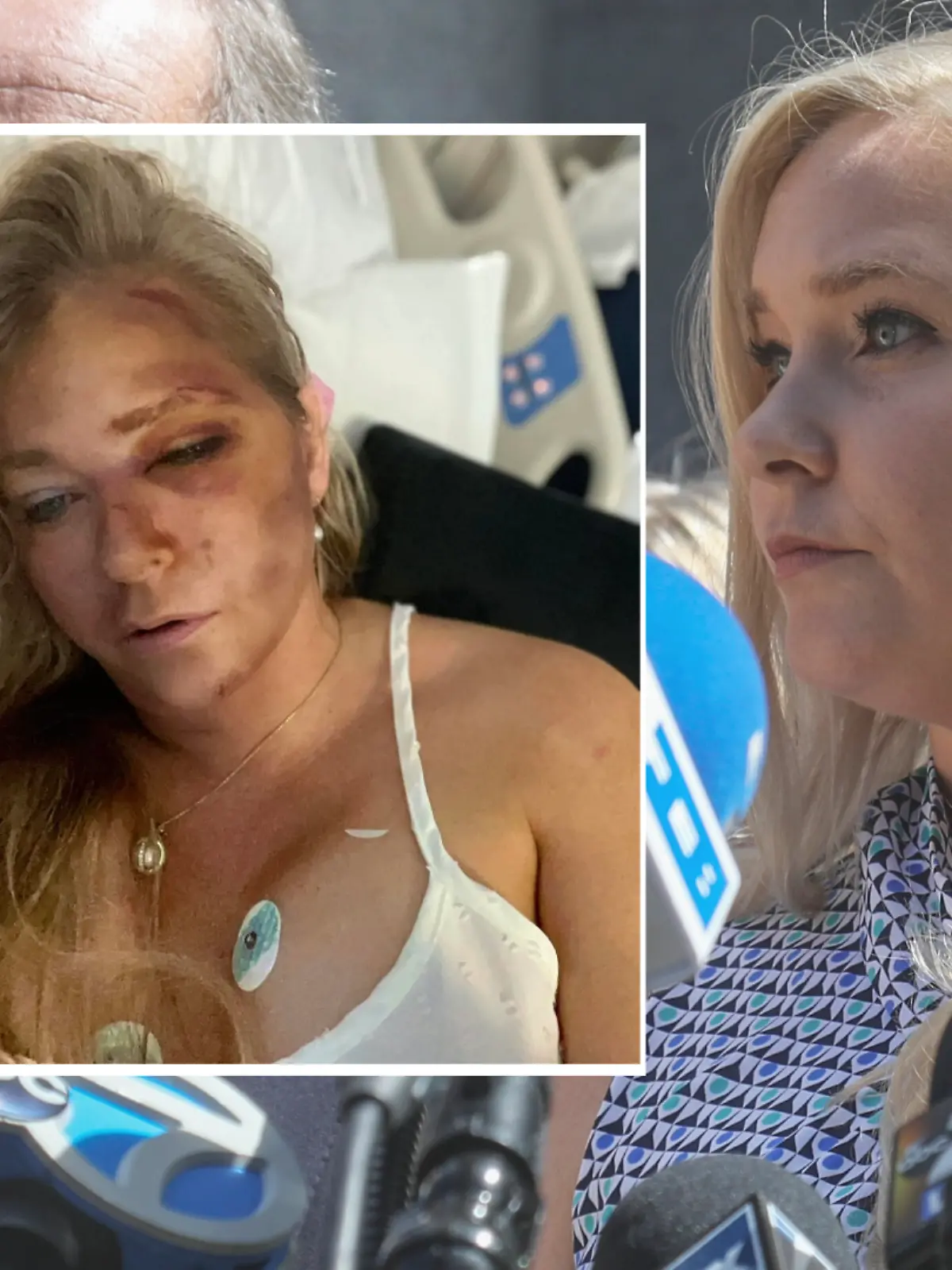 Bild zu: "Zehn Tage vor dem angeblichen Unfall! Eklat in der Familie von Virginia Giuffre"