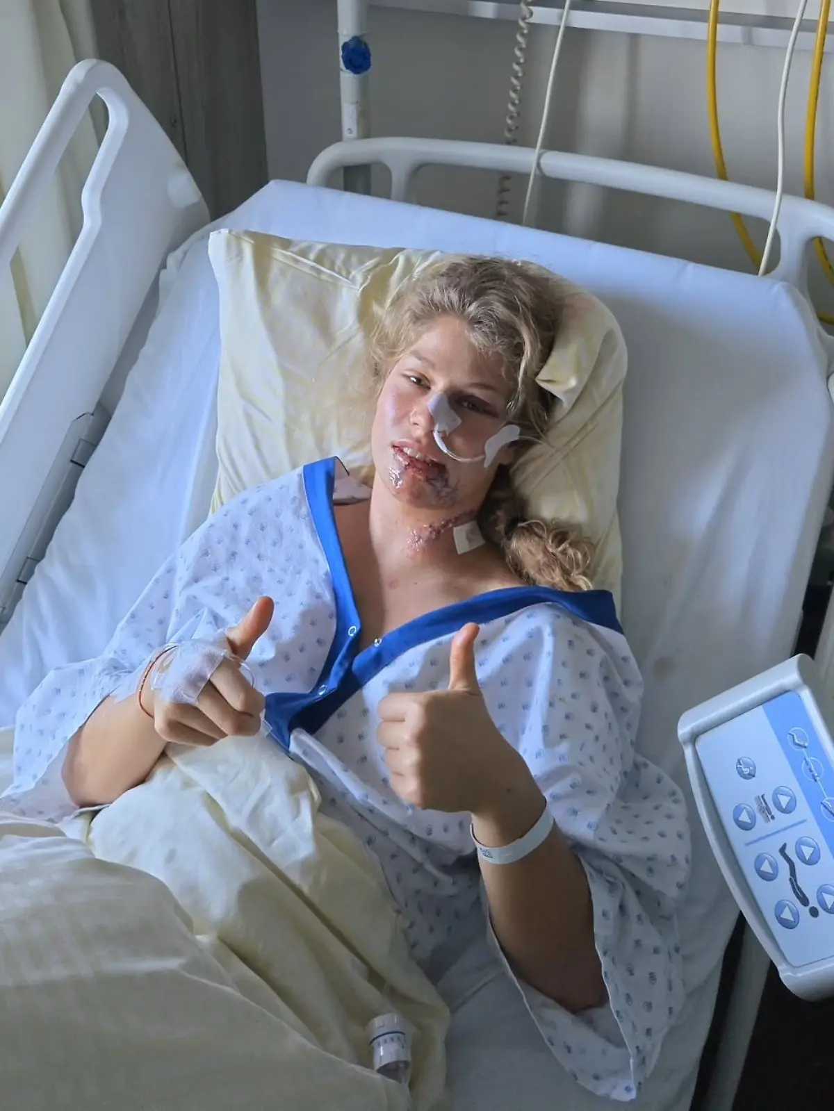 Cathia Schär hat sich bei einem schweren Rad-Unfall im Training schwere Verletzungen zugezogen. 