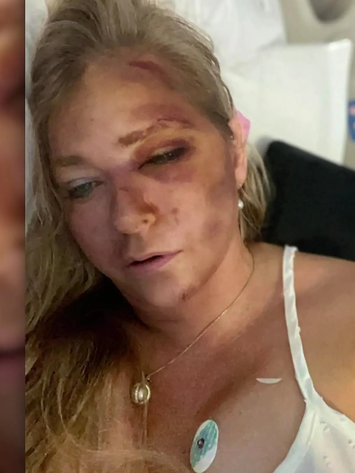 Bild zu: "Virginia Giuffre irritiert nach Autounfall mit neuem Statement "