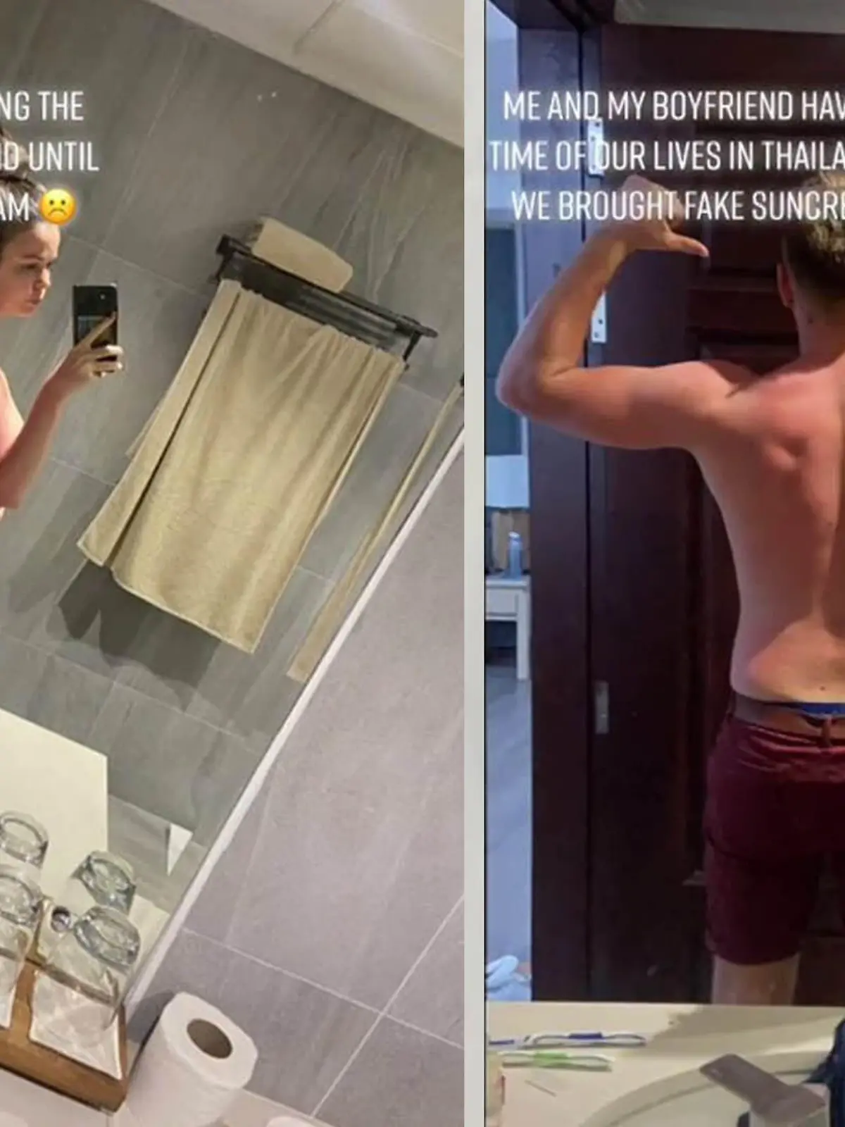 Das junge Paar cremt sich mit Fake-Sonnencreme ein und verbrennt komplett.
