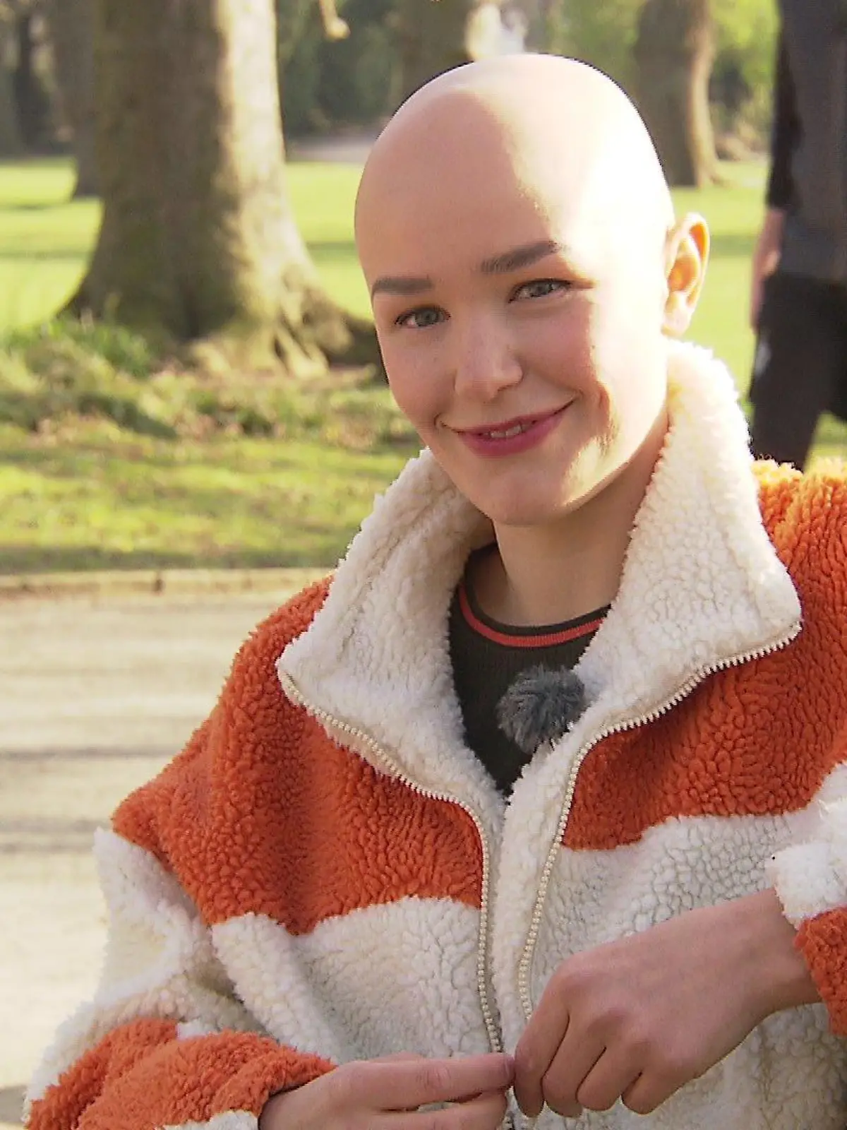 Anjoula lebt mit Alopecia areata - und ist stolz auf ihre Glatze!