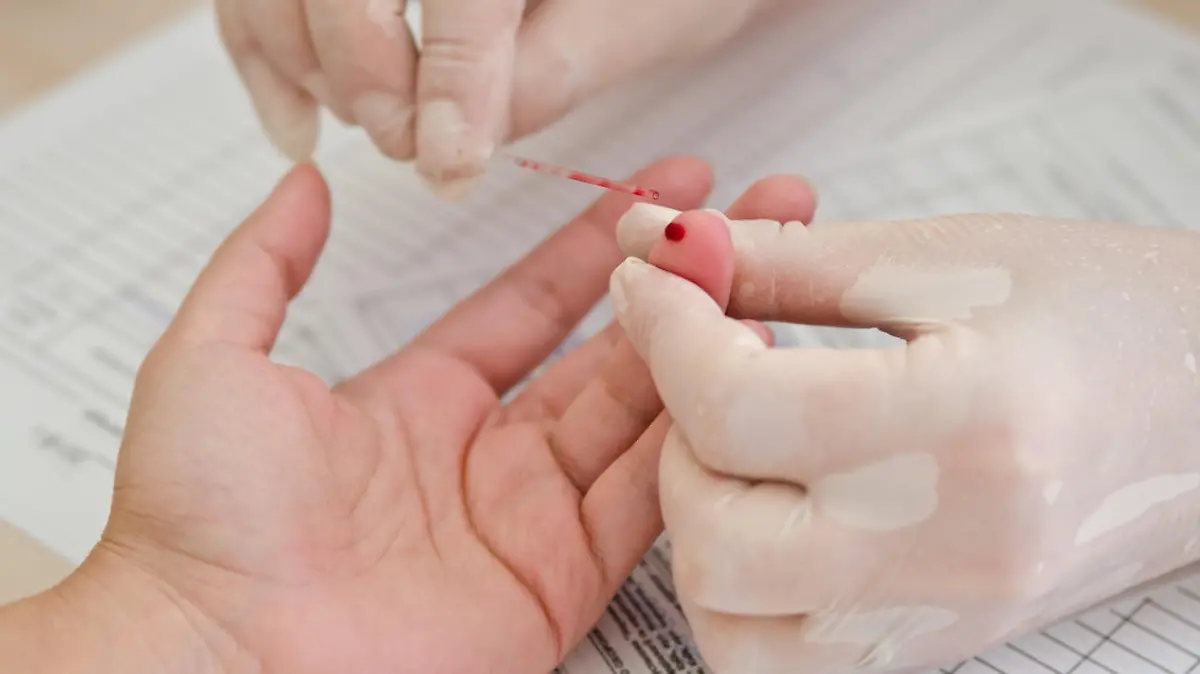 Arzt nimmt Blut am Finger des Patienten ab