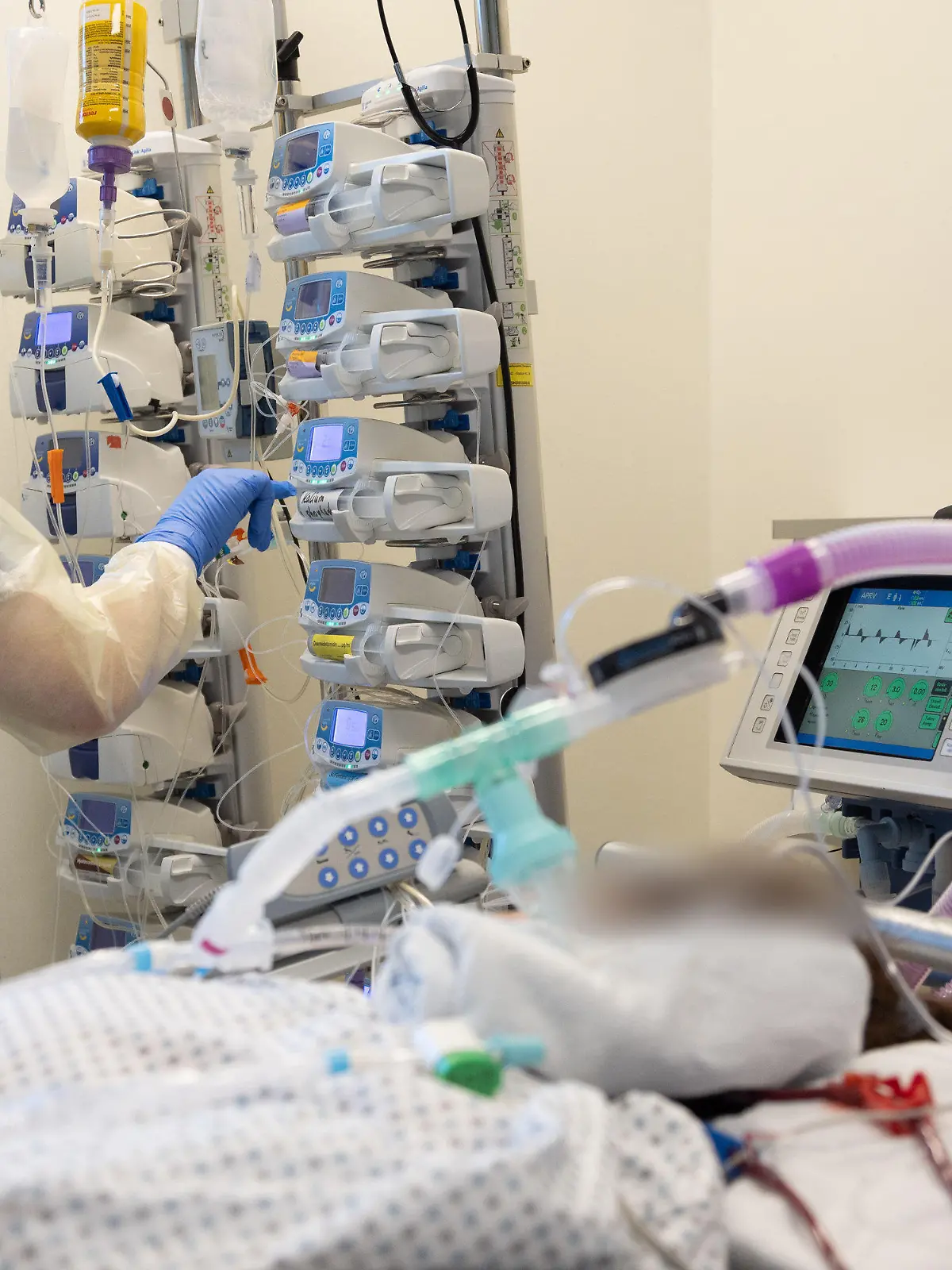 25.03.2022, Niedersachsen, Osnabrück: Ein Krankenpfleger versorgt einen schwer an Corona erkrankten Patienten auf der Intensivstation von einem Krankenhaus. Der Patient ist an Perfusoren angeschlossen und wird künstlich beatmet. Viele Patienten mit schweren Verläufen liegen mehrere Wochen auf der Intensivstation, rund die Hälfte der künstlich beatmeten Patienten stirbt. Foto: Friso Gentsch/dpa - ACHTUNG: Person(en) wurde(n) aus rechtlichen Gründen gepixelt +++ dpa-Bildfunk +++