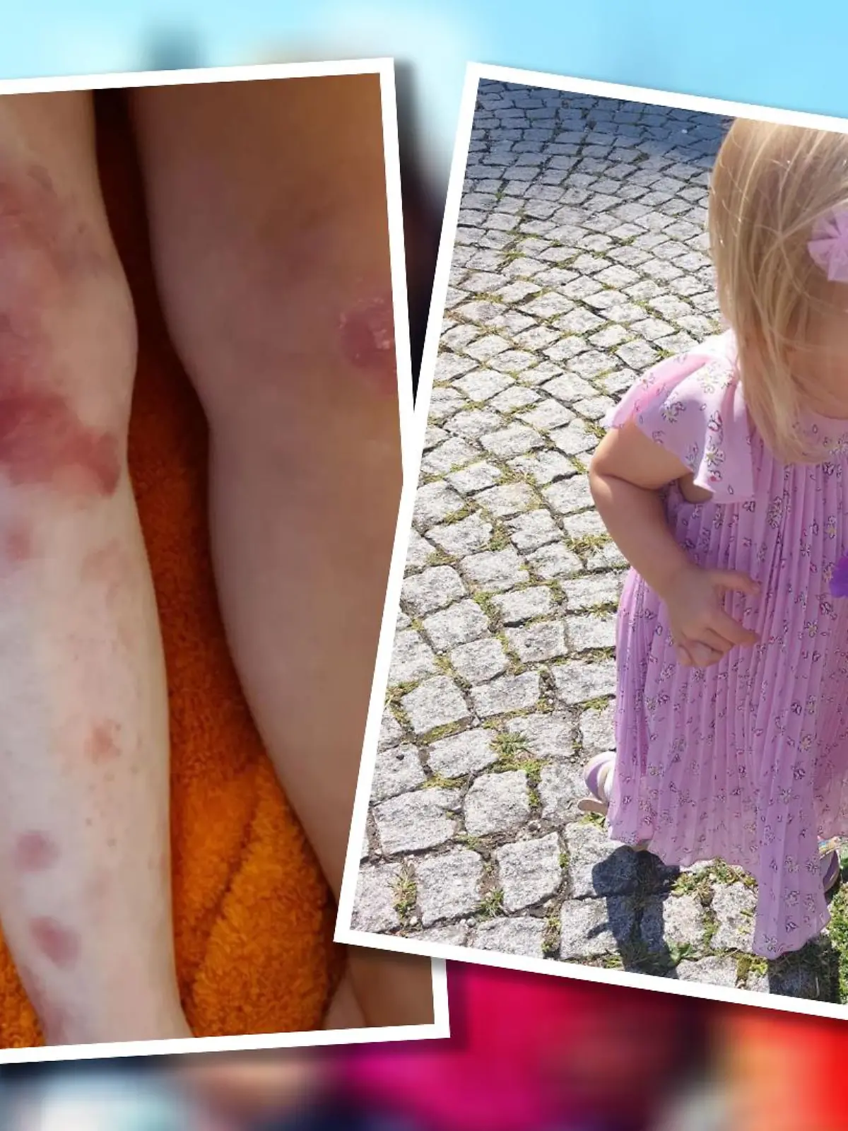 Die kleine Luana hat eine seltene Erkrankung.