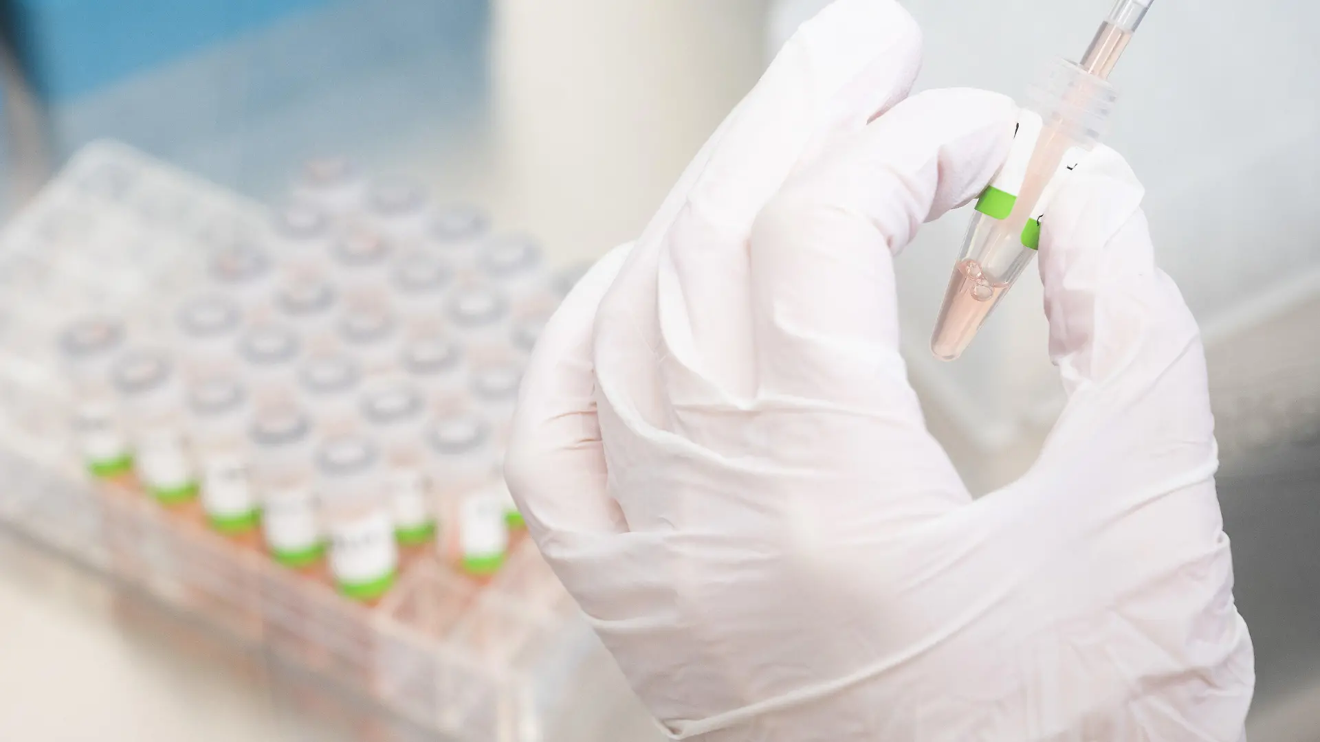 ARCHIV - 05.01.2022, Niedersachsen, Hannover: Eine biologisch-technische Assistentin bereitet PCR-Tests auf das Corona-Virus von Patienten im PCR-Labor vom Niedersächsischen Landesgesundheitsamt (NLGA) für die Analyse vor. Der inoffizielle Name Deltakron für Corona-Mischvarianten aus Delta und Omikron, die in mehreren Ländern gefunden wurden, ist aus Sicht von Fachleuten unglücklich gewählt. (zu dpa "Experten: Bezeichnung Deltakron für Mischvarianten nicht eindeutig") Foto: Julian Stratenschulte/dpa +++ dpa-Bildfunk +++