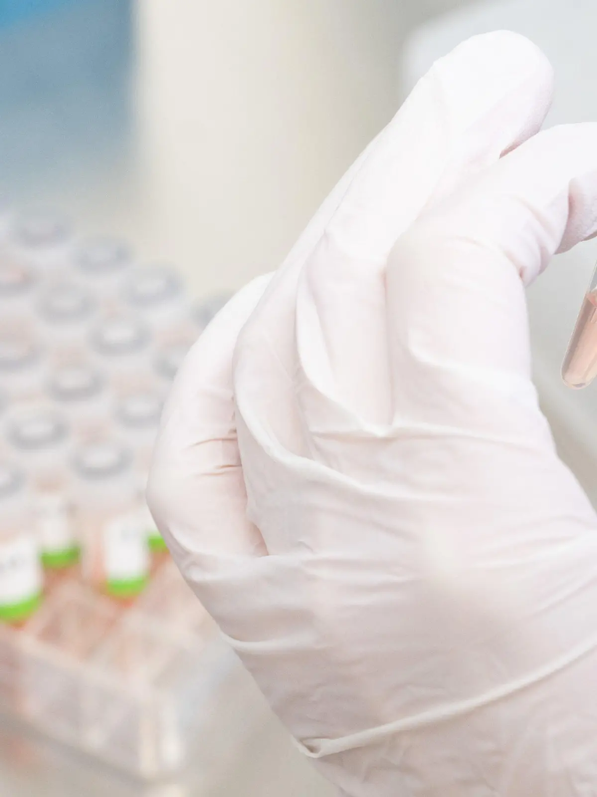 ARCHIV - 05.01.2022, Niedersachsen, Hannover: Eine biologisch-technische Assistentin bereitet PCR-Tests auf das Corona-Virus von Patienten im PCR-Labor vom Niedersächsischen Landesgesundheitsamt (NLGA) für die Analyse vor. Der inoffizielle Name Deltakron für Corona-Mischvarianten aus Delta und Omikron, die in mehreren Ländern gefunden wurden, ist aus Sicht von Fachleuten unglücklich gewählt. (zu dpa "Experten: Bezeichnung Deltakron für Mischvarianten nicht eindeutig") Foto: Julian Stratenschulte/dpa +++ dpa-Bildfunk +++