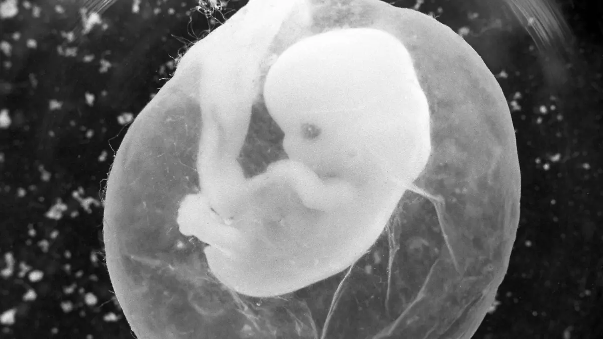 ARCHIV - Das undatierte Foto zeigt einen sieben Wochen alten Fötus in einer Fruchtblase. Erstmals seit Jahren ist die Zahl der Schwangerschaftsabbrüche in Deutschland wieder spürbar angestiegen. Wie das Statistische Bundesamt in Wiesbaden am Freitag (14.09.2012) mitteilte, wurden im zweiten Quartal diesen Jahres 26 900 Abtreibungen gemeldet. Das sind 300 Abbrüche beziehungsweise 1,2 Prozent mehr als im zweiten Quartal 2011. Foto: Peter Endig (zu dpa «Wieder mehr Abtreibungen in Deutschland» vom 14.09.2012)  +++(c) dpa - Bildfunk+++