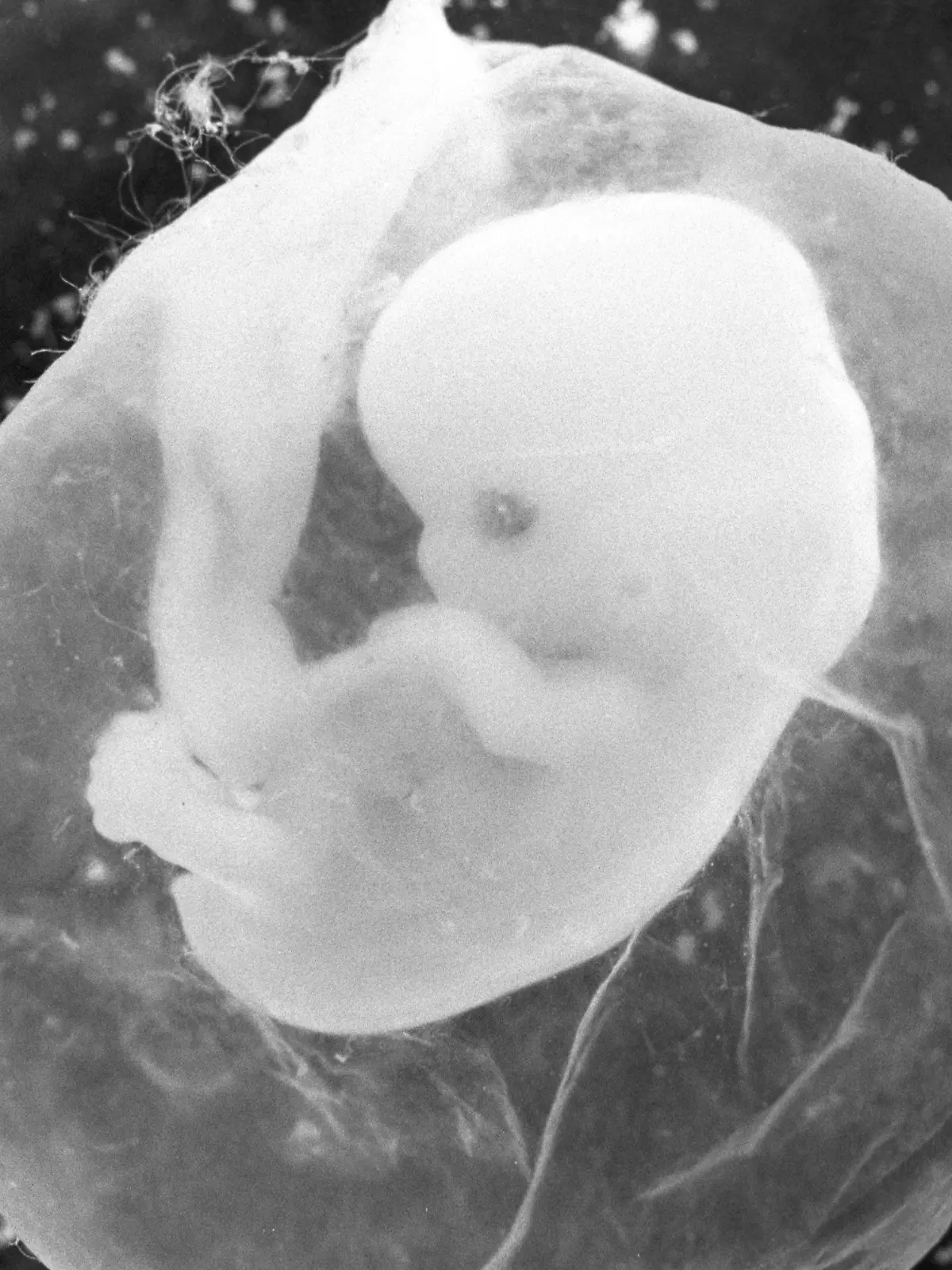 ARCHIV - Das undatierte Foto zeigt einen sieben Wochen alten Fötus in einer Fruchtblase. Erstmals seit Jahren ist die Zahl der Schwangerschaftsabbrüche in Deutschland wieder spürbar angestiegen. Wie das Statistische Bundesamt in Wiesbaden am Freitag (14.09.2012) mitteilte, wurden im zweiten Quartal diesen Jahres 26 900 Abtreibungen gemeldet. Das sind 300 Abbrüche beziehungsweise 1,2 Prozent mehr als im zweiten Quartal 2011. Foto: Peter Endig (zu dpa «Wieder mehr Abtreibungen in Deutschland» vom 14.09.2012)  +++(c) dpa - Bildfunk+++