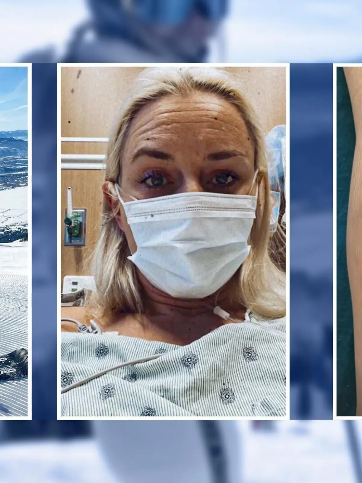 Lindsey Vonn wurde erneut am Knie operiert.