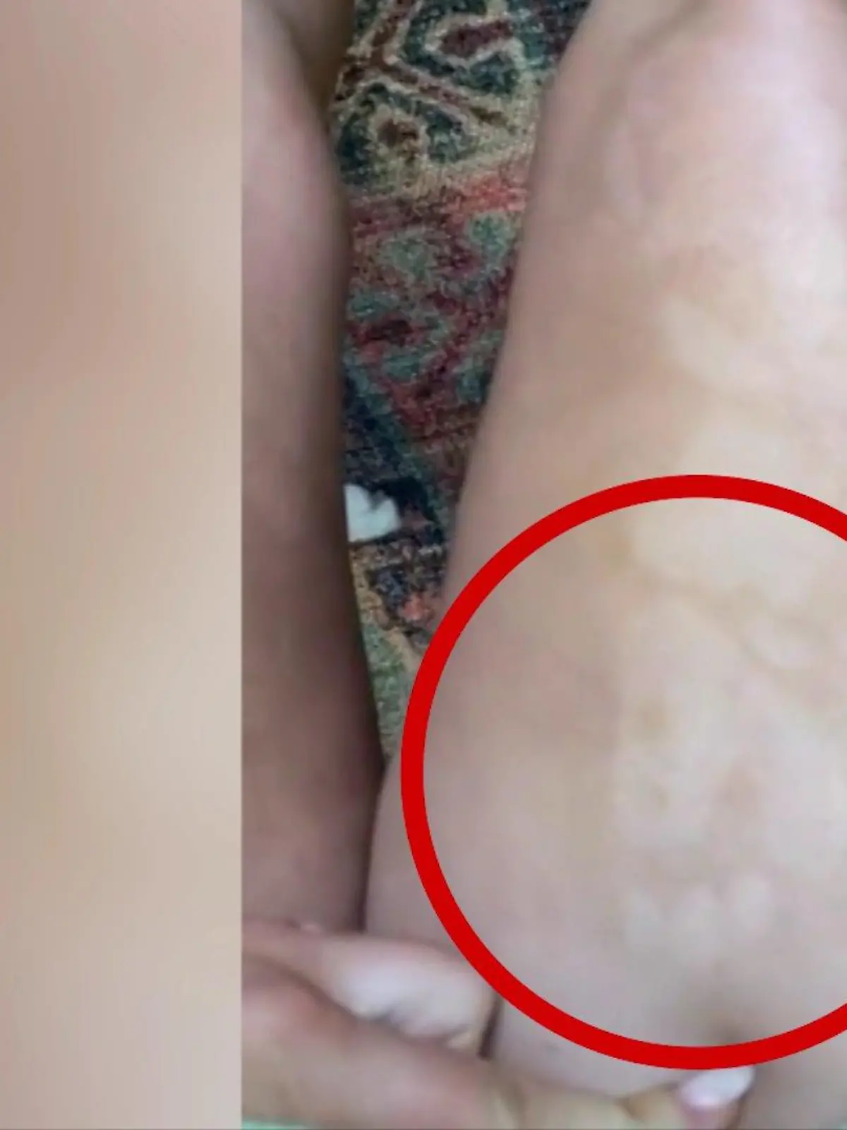 Bridgette Hartt mit ihrem Selbstbräunungs-Fail
